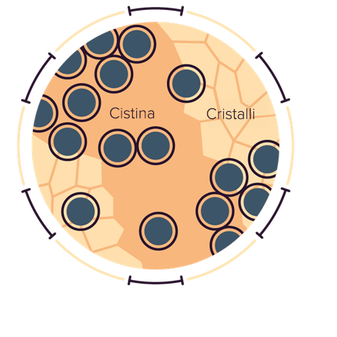cistina